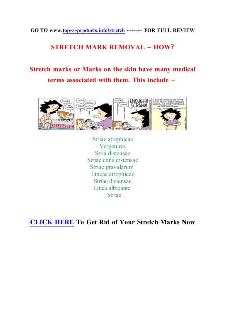 Stretch Marks Medical Definition And Treatment Advice