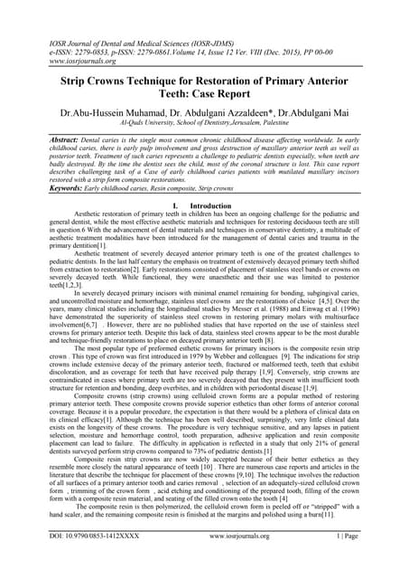 Vonlay; A paradigm shift in post endodontic restoration: A case report ...