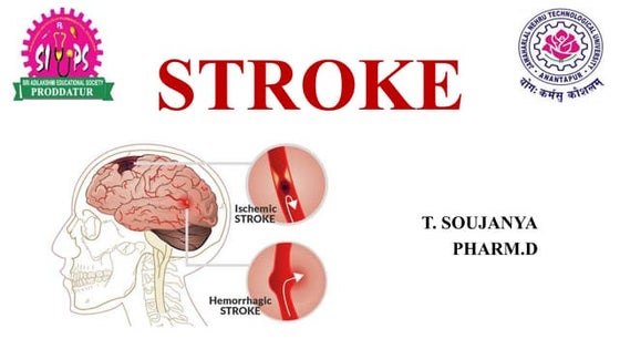 Stroke and management | PPT