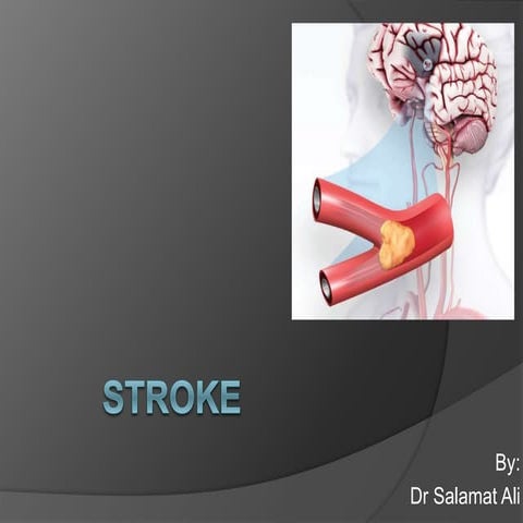 Stroke