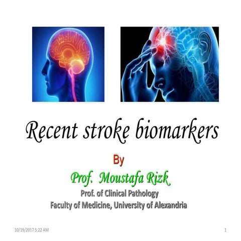 Recent stroke biomarkers