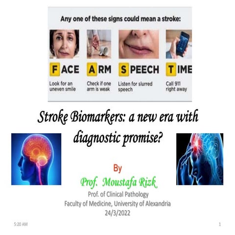 stroke biomarkers a new era with diagnostic promise.pptx