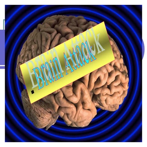 Nursing Care of Clients with Stroke