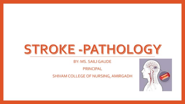 STROKE AND ITS TYPES - PATHOLOGY LECTURE