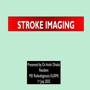 Stroke Imaging: Fundamental principles and concepts