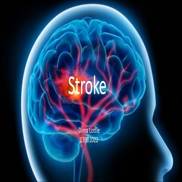 Stroke imaging
