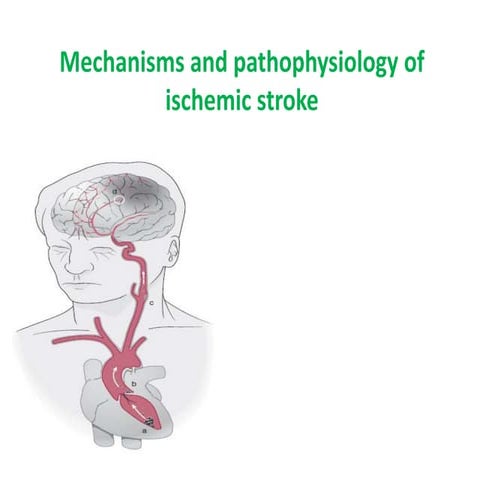 Stroke patho physiology