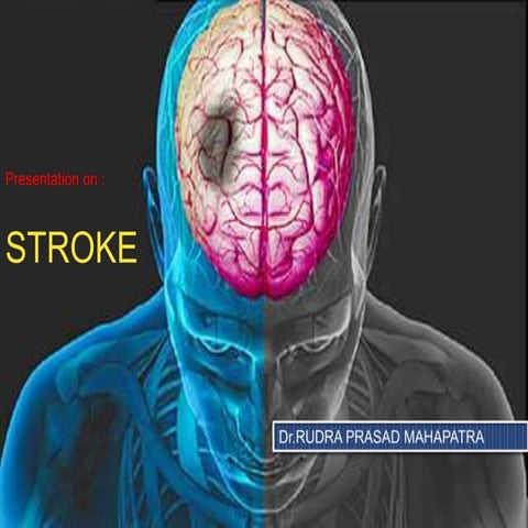 Ppt Pathogenesis Of Stroke Ischemia Hemorrhage