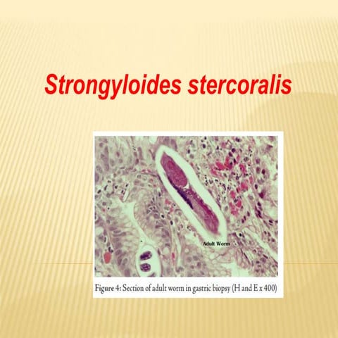 Powerpoint strongyloides stercoralis.ppt