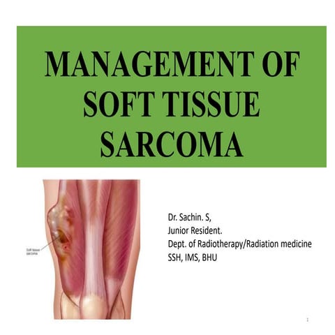 Management principles of soft tissue sarcoma