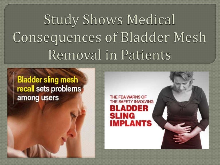 Study Shows Medical Consequences of Bladder Mesh Removal in Patients