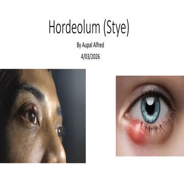 Stye | PPTX