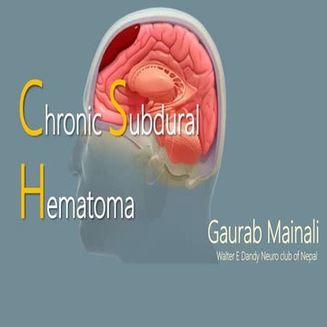 Chronic Subdural hematoma