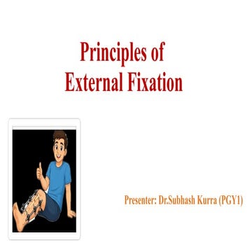 Principles of Internal Fixation.pptx