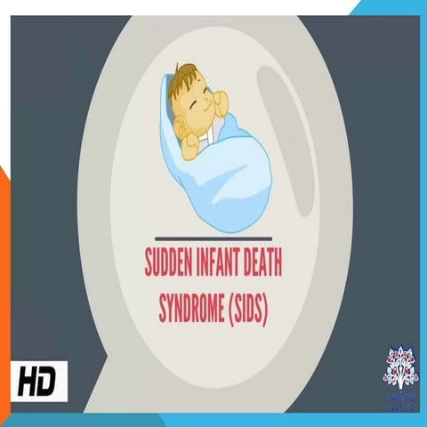 sudden infant death syndrome.pptxllllllll | PPT