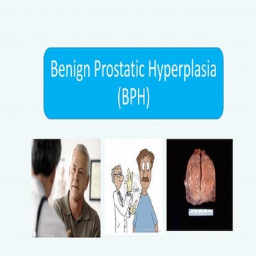 Benign Prostatic hyperplasia