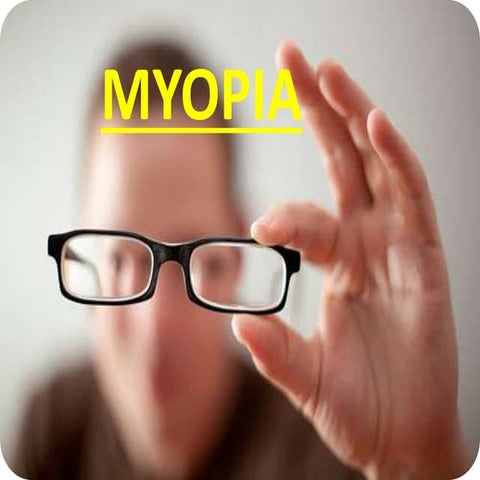  myopia