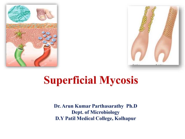 Superficial Mycosis.pptx
