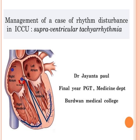 Supra ventricular tachyarrhythmia    