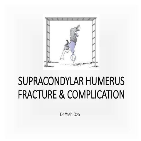 Supracondylar humerus fracture & complication for MBBS students