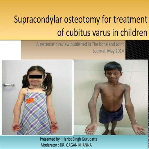 Supracondylar osteotomy for treatment of cubitus varus