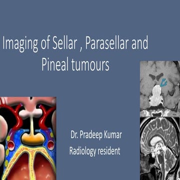 Sellar, Suprasellar and Pineal tumor final pk .ppt