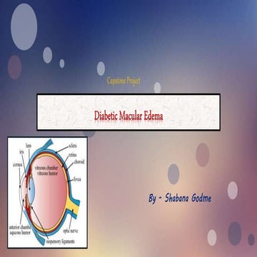 Diabetic Macular Edema (Surgery presentation)
