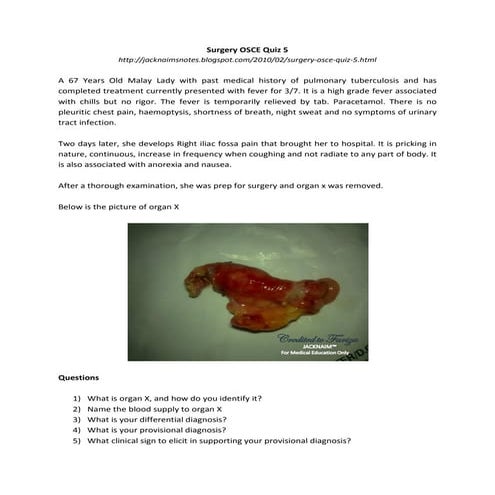 SURGERY MCQs(1).pdf