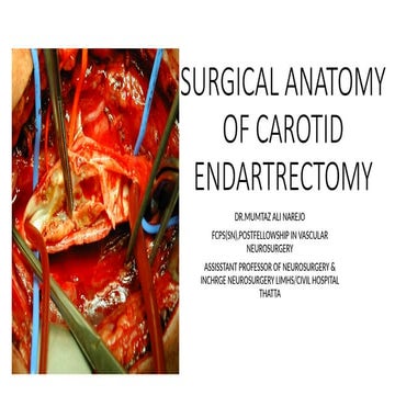 Surgical anatomy of carotid endartrectomy by Dr.Mumtaz  Ali.pptx