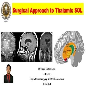 Surgical approach to thalamus