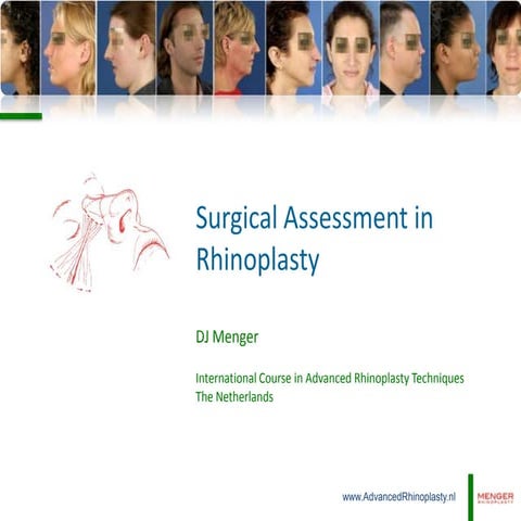 Surgical Assessment in Rhinoplasty | PPTX