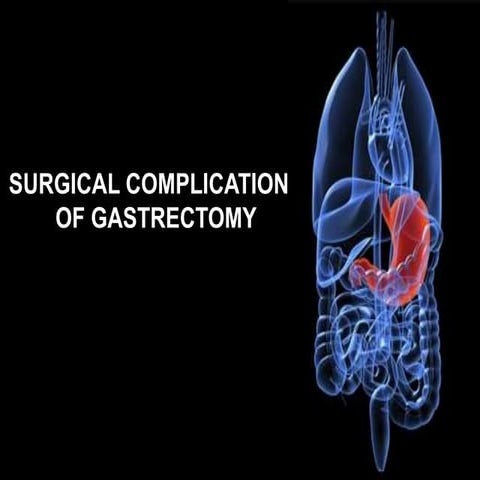 Surgical complications of Gastrectomy
