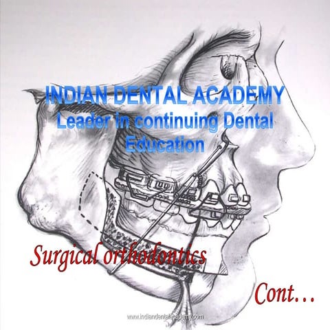 Surgical orthodontics / dental crown & bridge courses