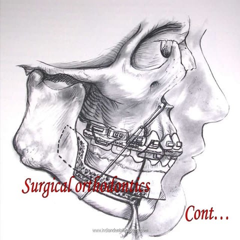 Surgical orthodontics/dental crown & bridge courses