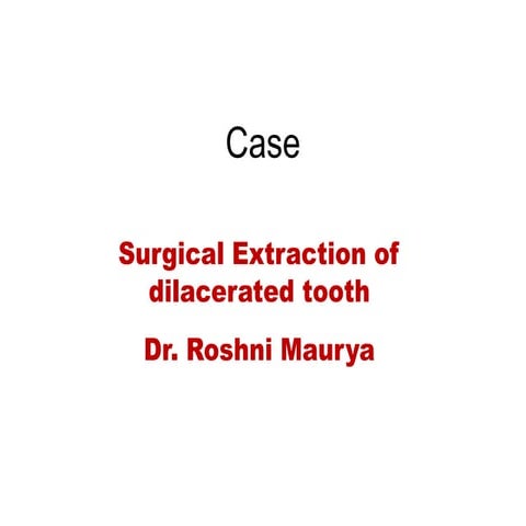 Surgical extraction of dilacerated tooth