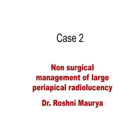 Surgical extraction of supernumerary tooth