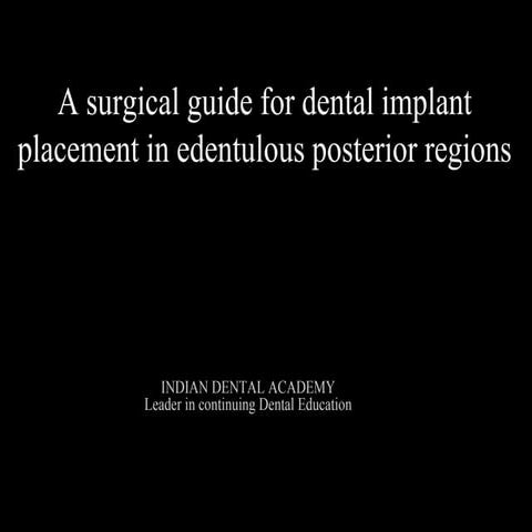 Surgical implant placement guides/prosthodontic courses