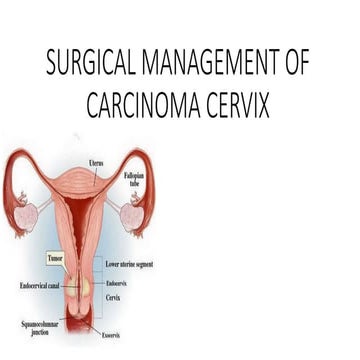 Surgical Treatment of CA Cervix 134.pptx