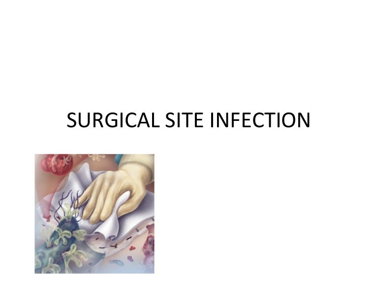 Surgical site infection (2)