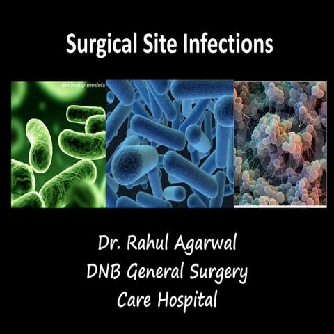 Surgical site infections - Diagnosis, treatment and Prevention guidelines