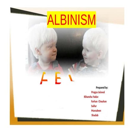ALBINISM , definition, Inheritance, Biochemical Basis,Types ...