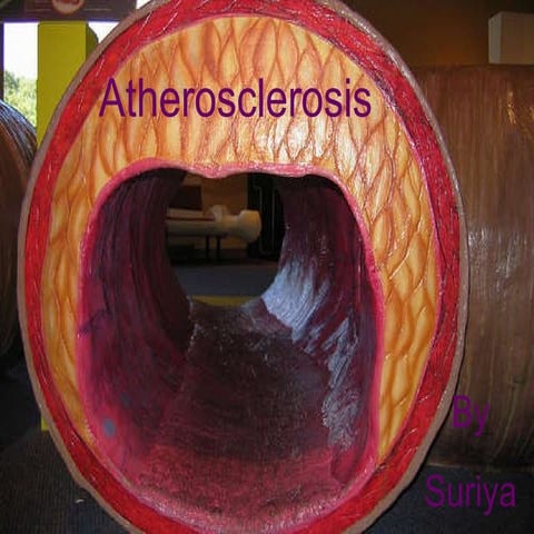 Atherosclerosis 1