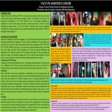 Vacuum assisted closure