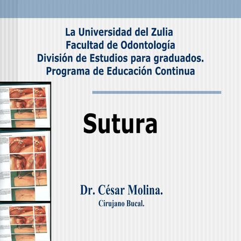 Sutura