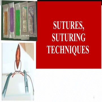 Different Types of Sutures | PDF