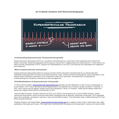 @CASE PRESENTATION ON SVT(SUPRA VENTRICULAR TACHYCARDIA.pptx