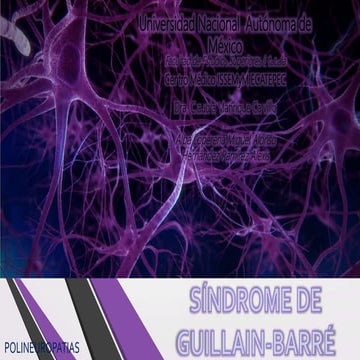 Sx guillain-barre