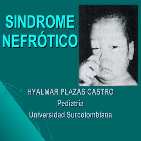Sindrome Nefrótico