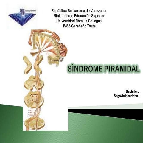 Sindrome piramidal