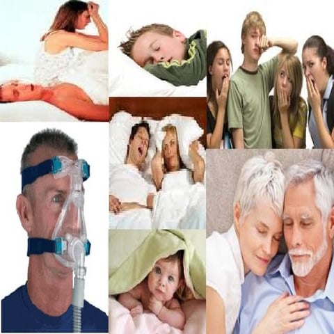 Syndrome d'apnee obstructive du sommeil | PPT